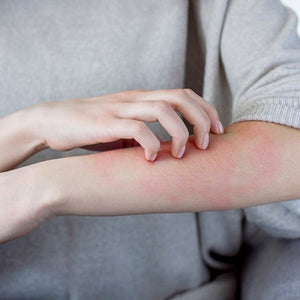 Bioderma’s Commitment to Dermatology: A Legacy of Skin Health